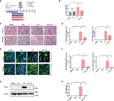 Retinoic Acid Alleviates Cisplatin-Induced Acute Kidney Injury Through Activation of Autophagy